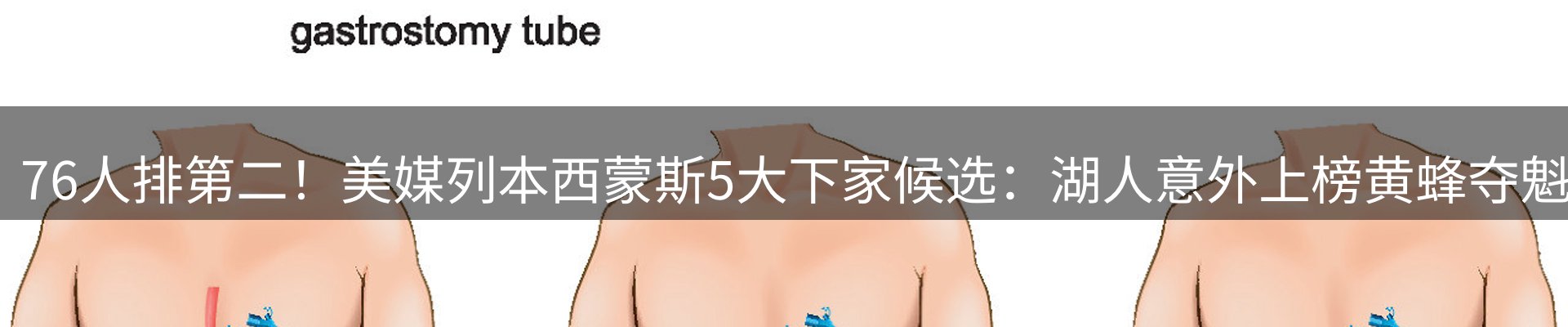 赛事资讯